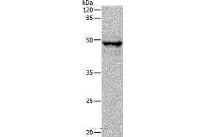 Western blot analysis of Mouse thymus tissue, using KRT15 Polyclonal Antibody at dilution of 1:400 (KRT15 antibody)