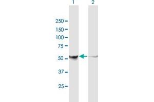 Western Blot analysis of PHGDH expression in transfected 293T cell line by PHGDH MaxPab polyclonal antibody. (PHGDH antibody  (AA 1-533))