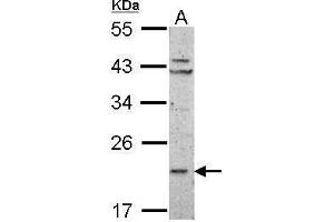 WB Image Sample (50 ug of whole cell lysate) A: mouse Liver 12% SDS PAGE antibody diluted at 1:1000 (RPL11 antibody)