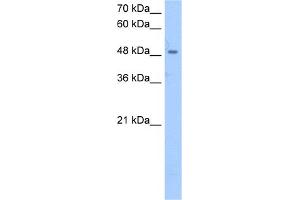 WB Suggested Anti-SSB Antibody Titration:  2. (SSB antibody  (Middle Region))