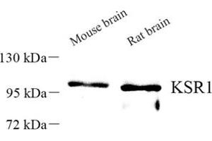 Western blot analysis of KSR1 (ABIN7074435) at dilution of 1: 500 (KSR1 antibody)