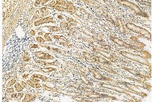 anti-Retinol Dehydrogenase 10 (All-Trans) (RDH10) (Internal Region) antibody