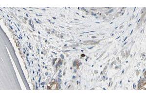 ABIN6279421 at 1/100 staining Human prostate tissue by IHC-P. (EIF3S1 antibody  (Internal Region))