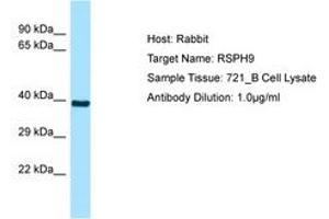Image no. 1 for anti-Radial Spoke Head 9 Homolog (RSPH9) (AA 52-101) antibody (ABIN6749895) (RSPH9 antibody  (AA 52-101))