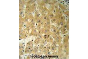 Immunohistochemistry (IHC) image for anti-Transthyretin (TTR) antibody (ABIN3002755) (TTR antibody)