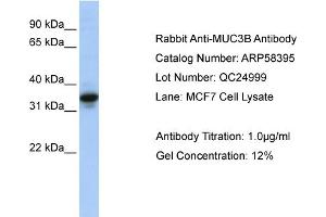 WB Suggested Anti-MUC3B  Antibody Titration: 0.