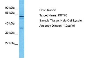 Host: Rabbit Target Name: KRT76 Sample Type: Hela Whole Cell lysates Antibody Dilution: 1. (Cytokeratin 2 antibody  (C-Term))