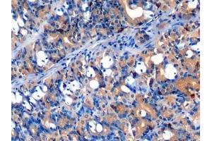 Immunohistochemistry (IHC) image for anti-Chromogranin A (CHGA) (AA 15-148) antibody (ABIN7433258)
