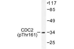Image no. 1 for anti-Cyclin-Dependent Kinase 1 (CDK1) (pThr161) antibody (ABIN317981) (CDK1 antibody  (pThr161))