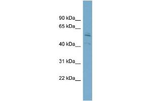 Western Blotting (WB) image for anti-Syntrophin, beta 1 (Dystrophin-Associated Protein A1, 59kDa, Basic Component 1) (SNTB1) (N-Term) antibody (ABIN2781530)