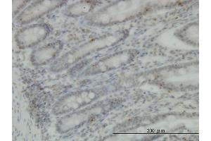 Immunoperoxidase of monoclonal antibody to PRKG1 on formalin-fixed paraffin-embedded human small Intestine. (PRKG1 antibody  (AA 73-170))