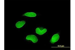 Immunofluorescence of monoclonal antibody to RUNX1T1 on HeLa cell. (RUNX1T1 antibody  (AA 416-525))