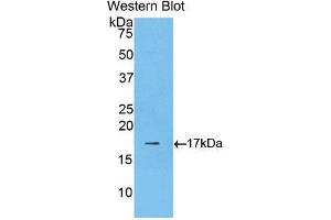 Western blot analysis of the recombinant protein. (LGALS9B antibody  (AA 17-148))