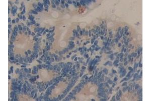 Detection of C7 in Rat Intestine Tissue using Polyclonal Antibody to Complement Component 7 (C7) (C7 antibody  (AA 1-144))