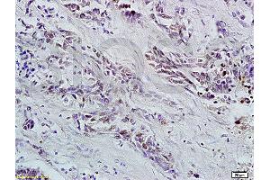 Formalin-fixed and paraffin embedded rat brain tissue labeled with Anti OCT4B-190 Polyclonal Antibody, Unconjugated (ABIN704531) at 1:200 followed by conjugation to the secondary antibody and DAB staining (Oct-4BOCT4B-190NT (AA 201-300) antibody)
