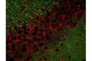 Immunohistochemistry (IHC) image for anti-Cell Adhesion Molecule 2 (CADM2) (AA 167-181) antibody (ABIN1742492) (CADM2 antibody  (AA 167-181))