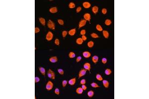 Immunofluorescence analysis of L929 cells using SMPD4 Rabbit pAb (ABIN7270531) at dilution of 1:100. (SMPD4 antibody  (AA 600-800))