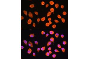 Immunofluorescence analysis of L929 cells using SMPD4 Rabbit pAb (ABIN7270531) at dilution of 1:100. (SMPD4 antibody  (AA 600-800))