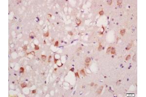 Formalin-fixed and paraffin embedded rat brain labeled with Anti-Phospho-ATG1(Ser556)Polyclonal Antibody, Unconjugated  at 1:200 followed by conjugation to the secondary antibody and DAB staining (ULK1 antibody  (pSer556))