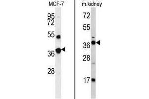 Image no. 1 for anti-Fructose-1,6-Bisphosphatase 1 (FBP1) (Middle Region) antibody (ABIN452992)