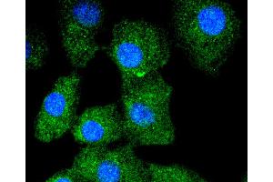 A549 cells were stained with Cytokeratin 13 (5A3) Monoclonal Antibody  at [1:200] incubated overnight at 4C, followed by secondary antibody incubation, DAPI staining of the nuclei and detection. (Cytokeratin 13 antibody)