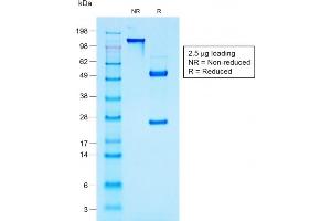 SDS-PAGE (SDS) image for anti-Mucin 1 (MUC1) antibody (ABIN6940097)