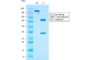 SDS-PAGE Analysis Purified MUC1 Mouse Recombinant Monoclonal Antibody (rMUC1/960). (Recombinant MUC1 antibody)