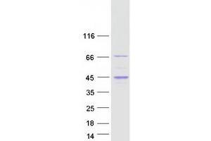 Validation with Western Blot