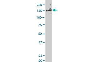 SLK monoclonal antibody (M01), clone 3E9 Western Blot analysis of SLK expression in Hela S3 NE . (SLK antibody  (AA 1126-1235))