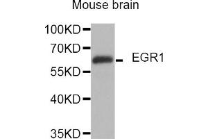 Western blot analysis of extracts of mouse brain, using EGR1 antibody (ABIN5974370).