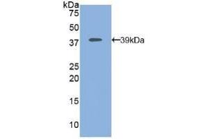 Detection of Recombinant MAP2K1, Human using Polyclonal Antibody to Mitogen Activated Protein Kinase Kinase 1 (MAP2K1) (MEK1 antibody  (AA 54-369))