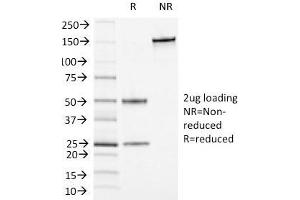 SDS-PAGE Analysis Purified CD13 Mouse Monoclonal Antibody (APN/1464). (CD13 antibody)