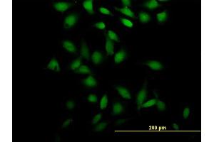 Immunofluorescence of purified MaxPab antibody to PSRC2 on HeLa cell. (ZFC3H1 antibody  (AA 1-358))