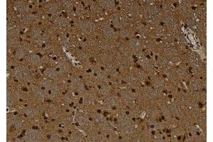MAGEC1 antibody