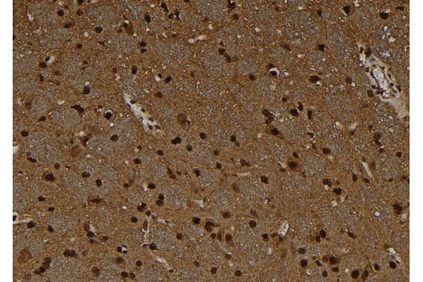 MAGEC1 antibody