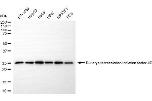 anti-Eukaryotic Translation Initiation Factor 4E (EIF4E) antibody