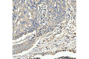 IHC analysis of CD63 using anti-CD63 antibody (ABIN3043395). (CD63 antibody  (AA 97-238))