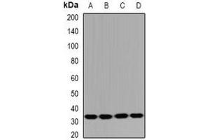 Western blot analysis of HUS1B expression in Jurkat (A), mouse spleen (B), mouse thymus (C), rat testis (D) whole cell lysates.