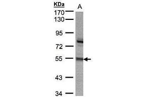 WB Image Sample(30 ug whole cell lysate) A:293T 7. (ZNF165 antibody)