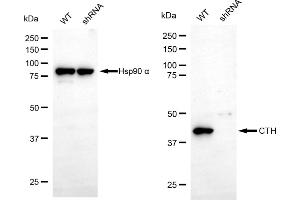 Western blotting analysis using CTH antibody (ABIN7798233).
