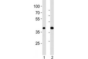 Western blot analysis of lysate from 1) mouse pancreas and 2) rat pancreas tissue using PDX1 antibody at 1:1000.