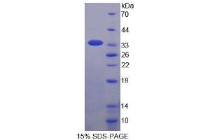SDS-PAGE analysis of Human WWP2 Protein.