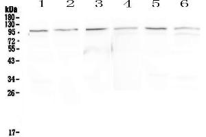 Western blot analysis of MVP using anti-MVP antibody . (MVP antibody  (AA 2-259))