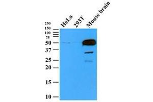 Cell lysates (35 ug) were resolved by SDS-PAGE, transferred to PVDF membrane and probed with anti-human TUBB2b (1:500). (TUBB2B antibody  (AA 1-445))