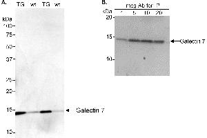 anti-Galectin 7 (LGALS7) (C-Term) antibody