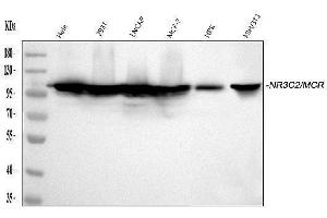 Western blot analysis of NR3C2 using anti-NR3C2 antibody (ABIN3043575).