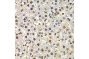 Immunohistochemistry of paraffin-embedded rat liver using TOR1A antibody at dilution of 1:200 (400x lens). (TOR1A antibody)