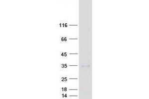 Validation with Western Blot