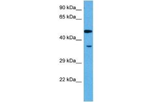 Western Blotting (WB) image for anti-Myocyte Enhancer Factor 2A (MEF2A) (N-Term) antibody (ABIN2778339)