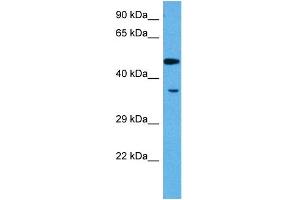 Host:  Rabbit  Target Name:  MEF2A  Sample Tissue:  Rat Skeletal Muscle  Antibody Dilution:  1ug/ml (MEF2A antibody  (N-Term))